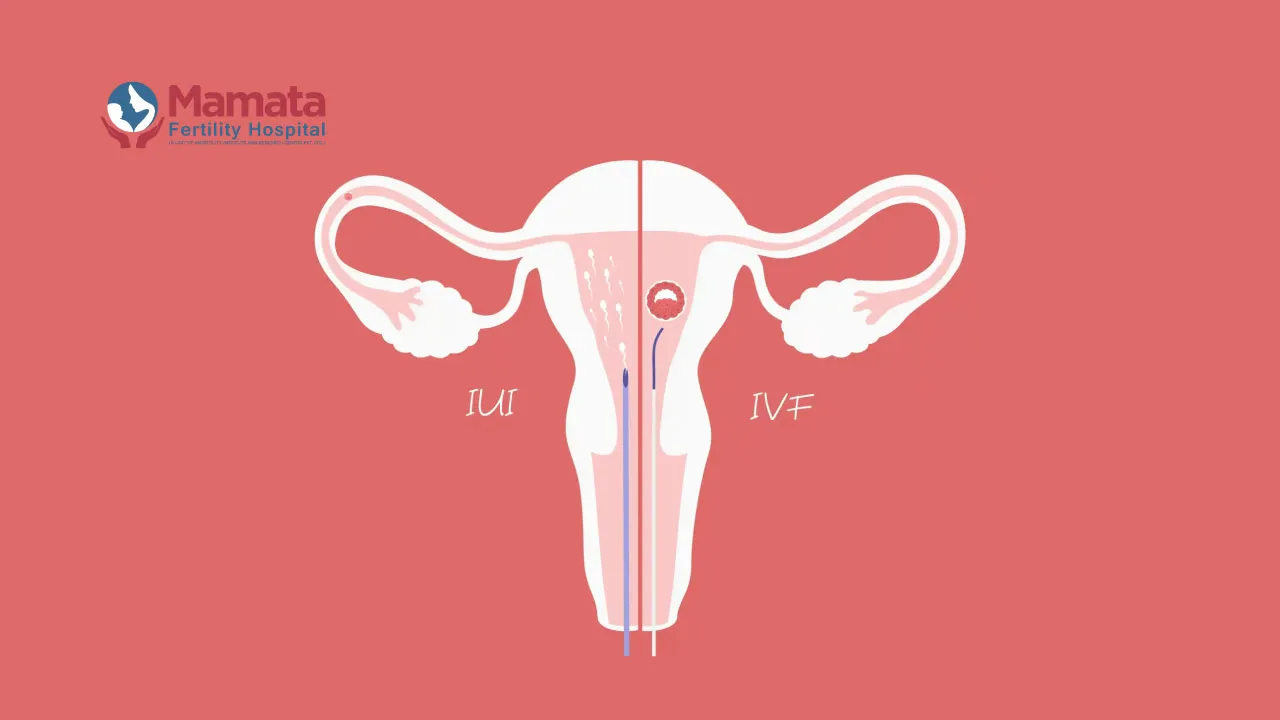 which is painful IUI or IVF