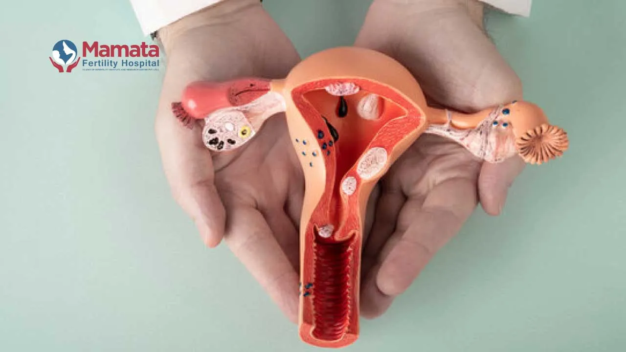 The Difference Between Endometriosis and Adenomyosis