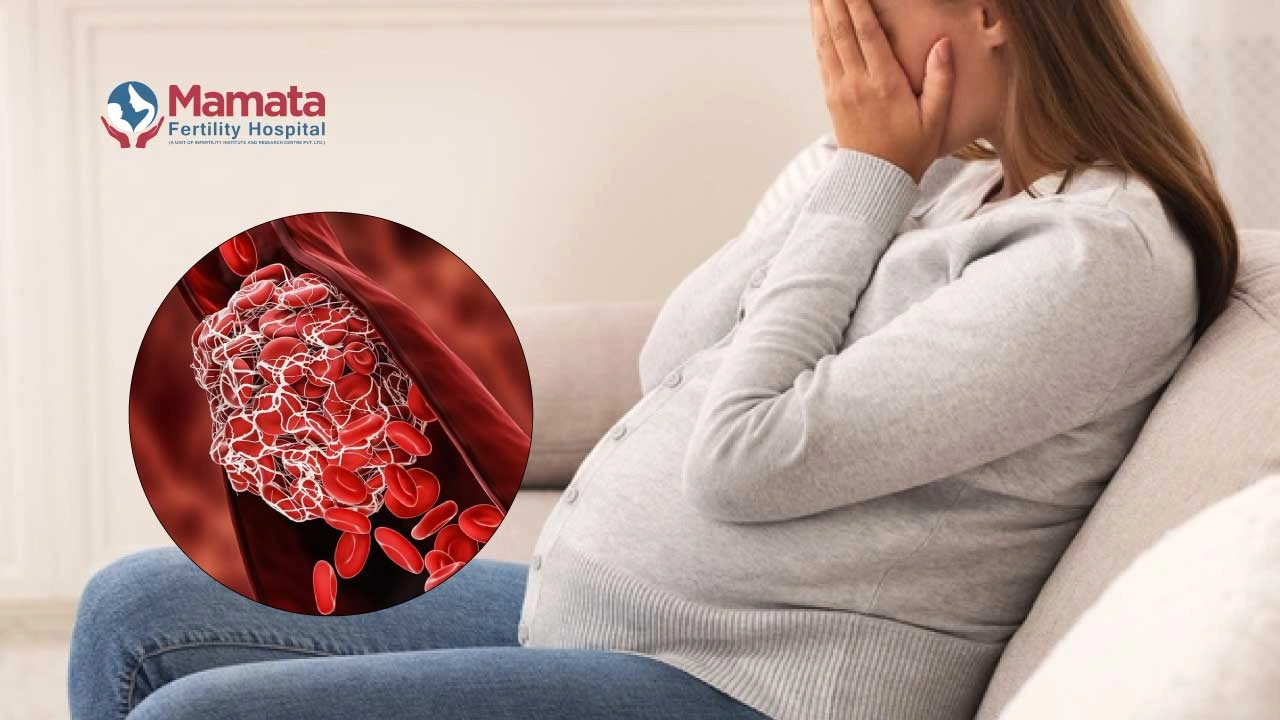 Understanding Your Risk for Blood Clots with Pregnancy