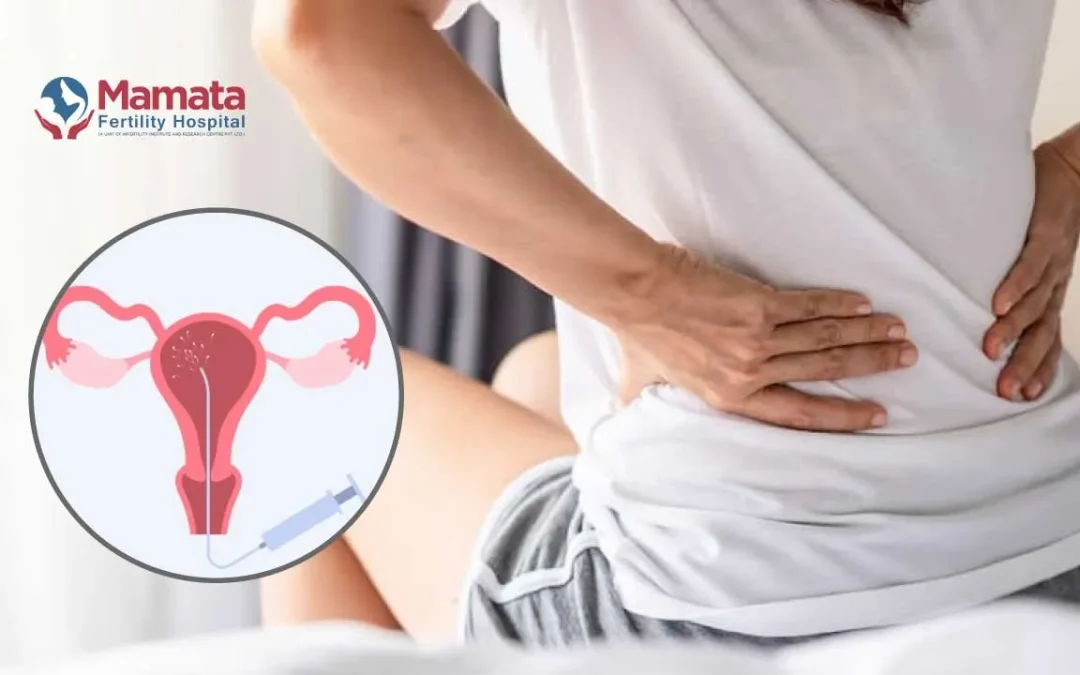 Back Pain After IUI and How to Manage It