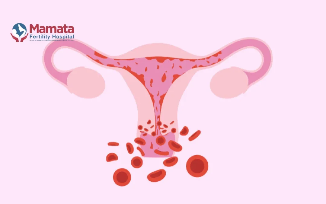 Brown Discharge After IUI