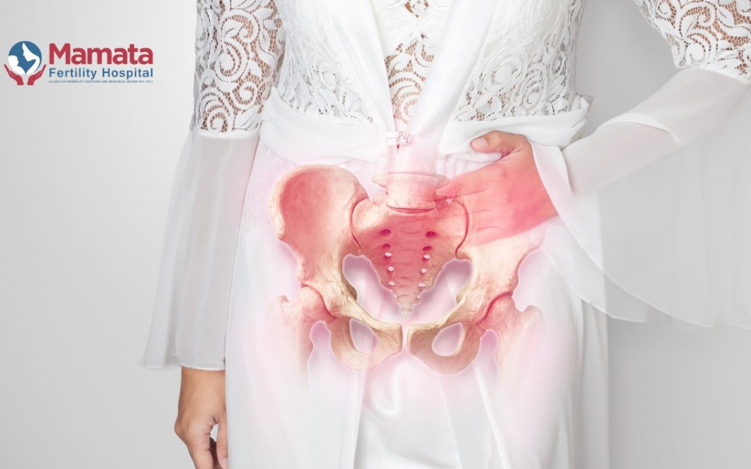 What Does Endometriosis Pelvic Pain Feel Like?
