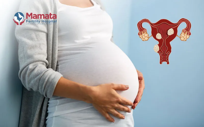 Can-Fibroids-Cause-Preterm-Labour