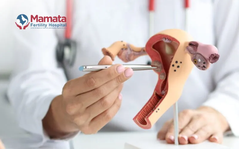 Is-Uterine-Fibroid-Embolization-Right-for-You