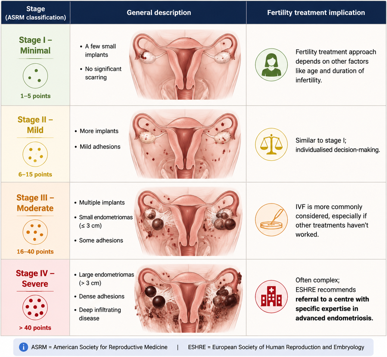 Stages of Endometriosis and What They Mean for Fertility Treatment<br />
